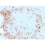 Immunohistochemistry - Anti-CD3 epsilon Antibody [C3e/1931] (A250494) - Antibodies.com