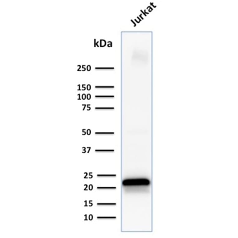Western Blot - Anti-CD3 epsilon Antibody [C3e/1931] (A250494) - Antibodies.com