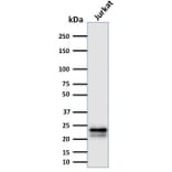 Western Blot - Anti-CD3 epsilon Antibody [C3e/2478] (A250496) - Antibodies.com