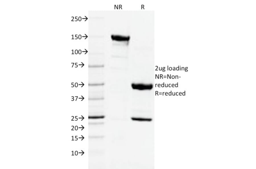 SDS-PAGE - Anti-CD3 epsilon Antibody [C3e/2478] (A250496) - Antibodies.com