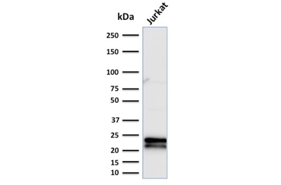 Western Blot - Anti-CD3 epsilon Antibody [C3e/2479] (A250497) - Antibodies.com