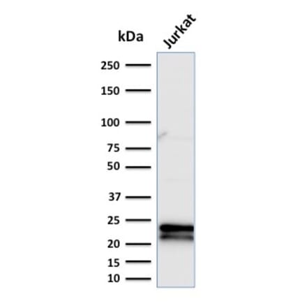 Western Blot - Anti-CD3 epsilon Antibody [C3e/2479] (A250497) - Antibodies.com