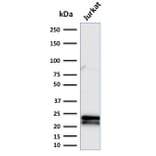 Western Blot - Anti-CD3 epsilon Antibody [C3e/2479] (A250497) - Antibodies.com