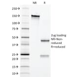 SDS-PAGE - Anti-CD3 epsilon Antibody [C3e/2479] (A250497) - Antibodies.com