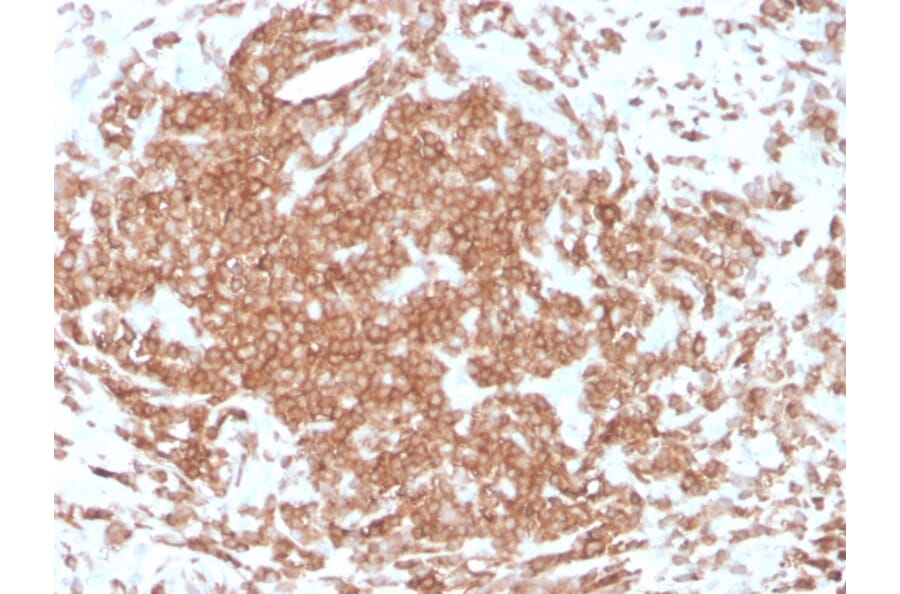 Immunohistochemistry - Anti-CD3 epsilon Antibody [rC3e/1308] (A250497) - Antibodies.com