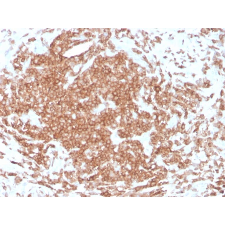 Immunohistochemistry - Anti-CD3 epsilon Antibody [rC3e/1308] (A250497) - Antibodies.com