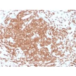 Immunohistochemistry - Anti-CD3 epsilon Antibody [rC3e/1308] (A250497) - Antibodies.com