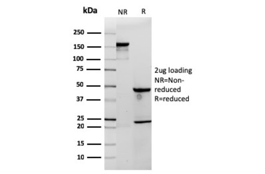 SDS-PAGE - Anti-CD3 epsilon Antibody [rC3e/1308] (A250498) - Antibodies.com
