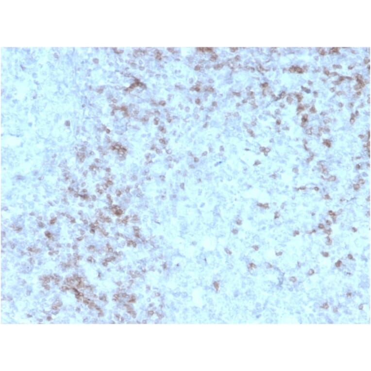 Immunohistochemistry - Anti-CD3 epsilon Antibody [rC3e/1931] (A250499) - Antibodies.com