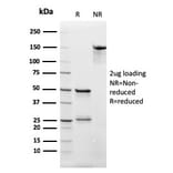 SDS-PAGE - Anti-CD3 epsilon Antibody [rC3e/2479] (A253679) - Antibodies.com