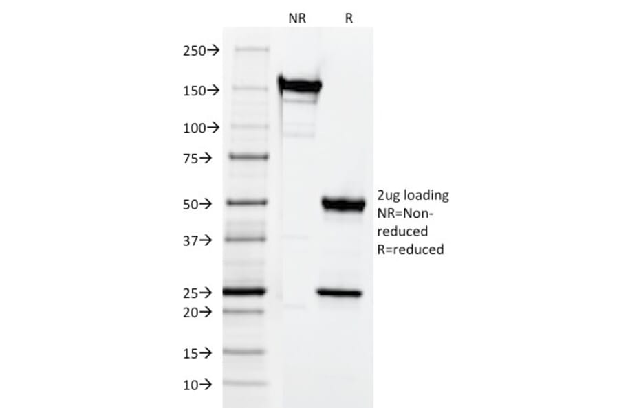 SDS-PAGE - Anti-CD3 epsilon Antibody [CRIS-7] (A250501) - Antibodies.com