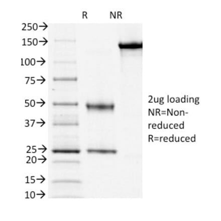 SDS-PAGE - Anti-CD3 epsilon Antibody [OKT3] (A250502) - Antibodies.com