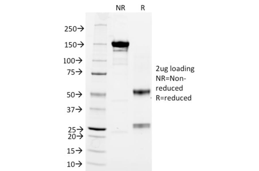 SDS-PAGE - Anti-CD3 epsilon Antibody [RIV9] (A250504) - Antibodies.com