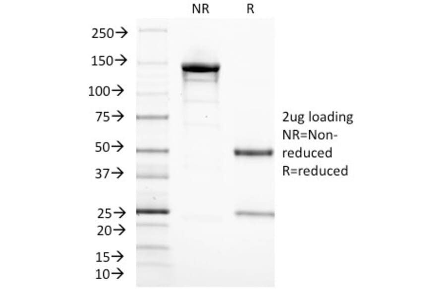 SDS-PAGE - Anti-CD3 epsilon Antibody [C3e/1308] (A250505) - Antibodies.com