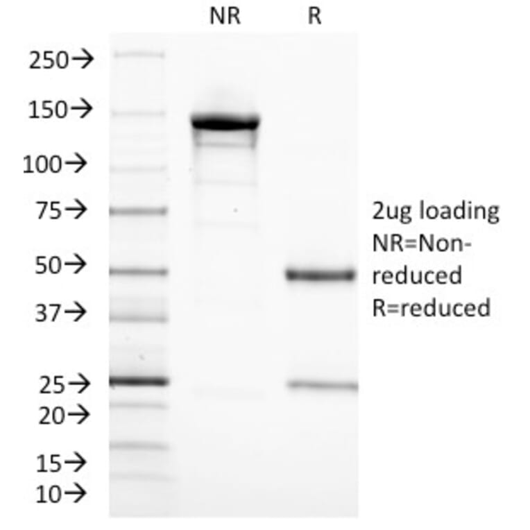 SDS-PAGE - Anti-CD3 epsilon Antibody [C3e/1308] (A250505) - Antibodies.com