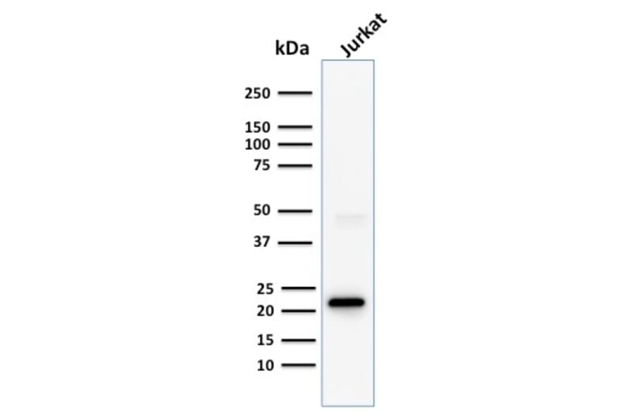 Western Blot - Anti-CD3 epsilon Antibody [C3e/1308] (A250505) - Antibodies.com