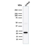 Western Blot - Anti-CD3 epsilon Antibody [C3e/1308] (A250505) - Antibodies.com
