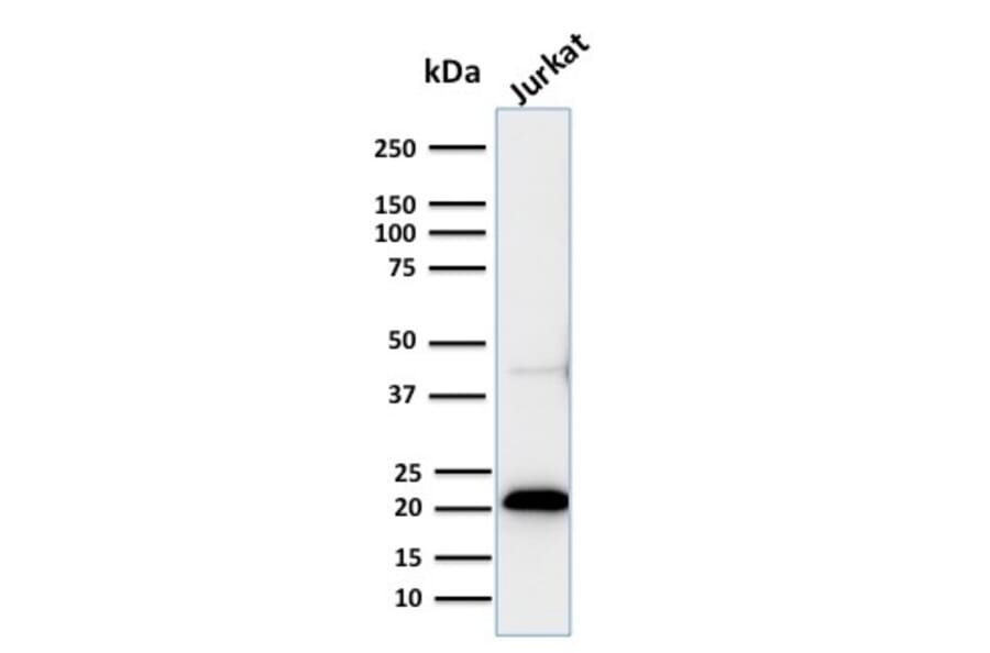 Western Blot - Anti-CD3 epsilon Antibody [C3e/2858R] (A250506) - Antibodies.com