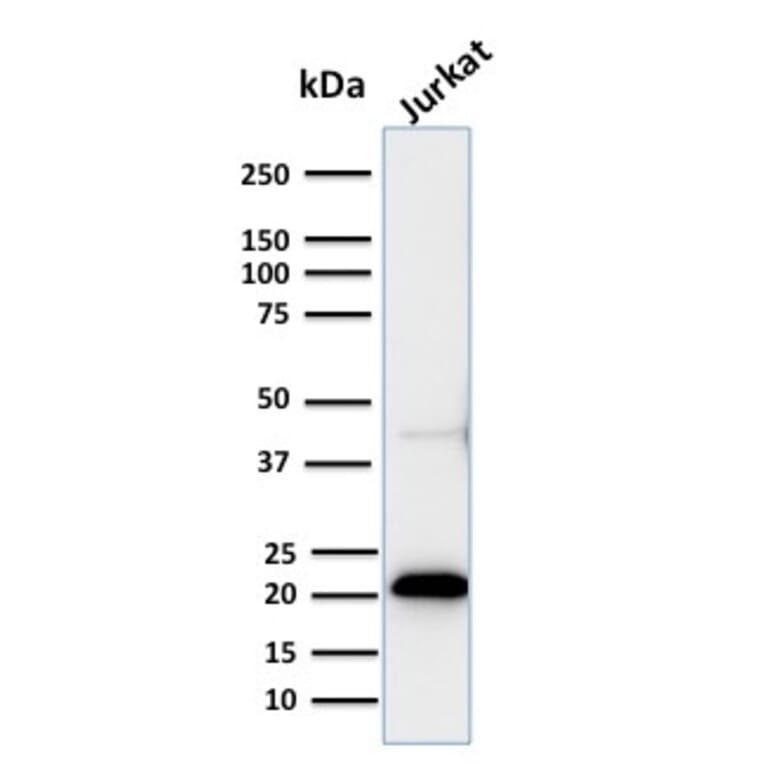 Western Blot - Anti-CD3 epsilon Antibody [C3e/2858R] (A250506) - Antibodies.com