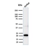 Western Blot - Anti-CD3 epsilon Antibody [C3e/2858R] (A250506) - Antibodies.com