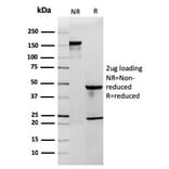 SDS-PAGE - Anti-CD3 epsilon Antibody [C3e/2858R] (A250506) - Antibodies.com