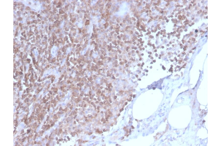 Immunohistochemistry - Anti-CD3 epsilon Antibody [C3e/2858R] (A250505) - Antibodies.com