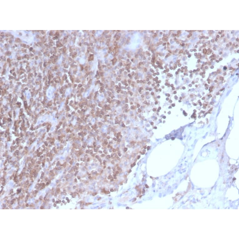 Immunohistochemistry - Anti-CD3 epsilon Antibody [C3e/2858R] (A250505) - Antibodies.com