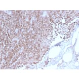 Immunohistochemistry - Anti-CD3 epsilon Antibody [C3e/2858R] (A250505) - Antibodies.com