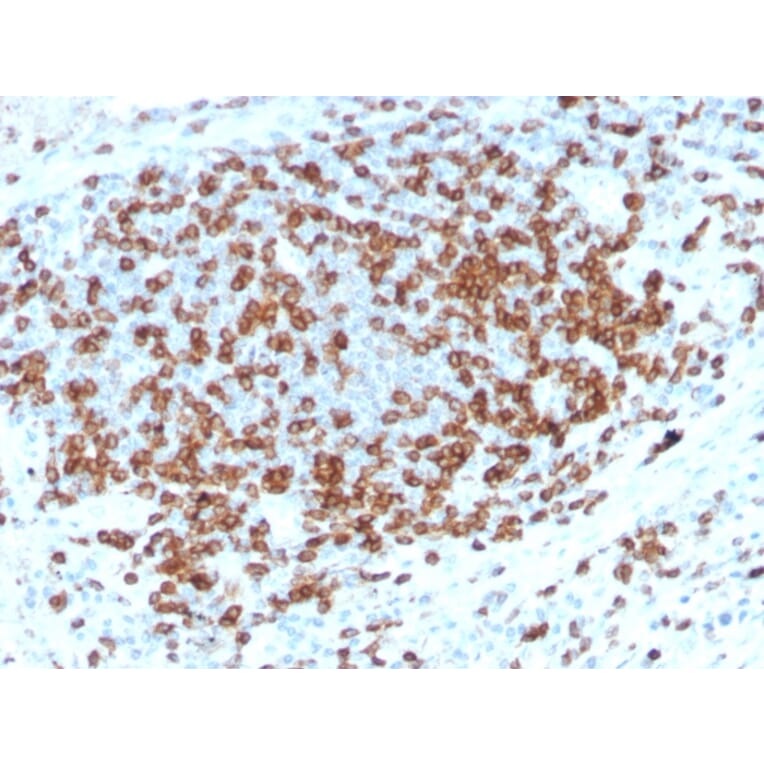 Immunohistochemistry - Anti-CD3 epsilon Antibody [C3e/3125R] (A250506) - Antibodies.com