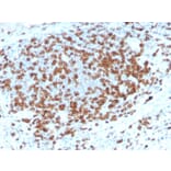 Immunohistochemistry - Anti-CD3 epsilon Antibody [C3e/3125R] (A250506) - Antibodies.com