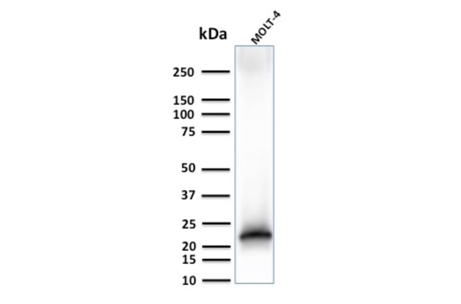 Western Blot - Anti-CD3 epsilon Antibody [C3e/3125R] (A250507) - Antibodies.com