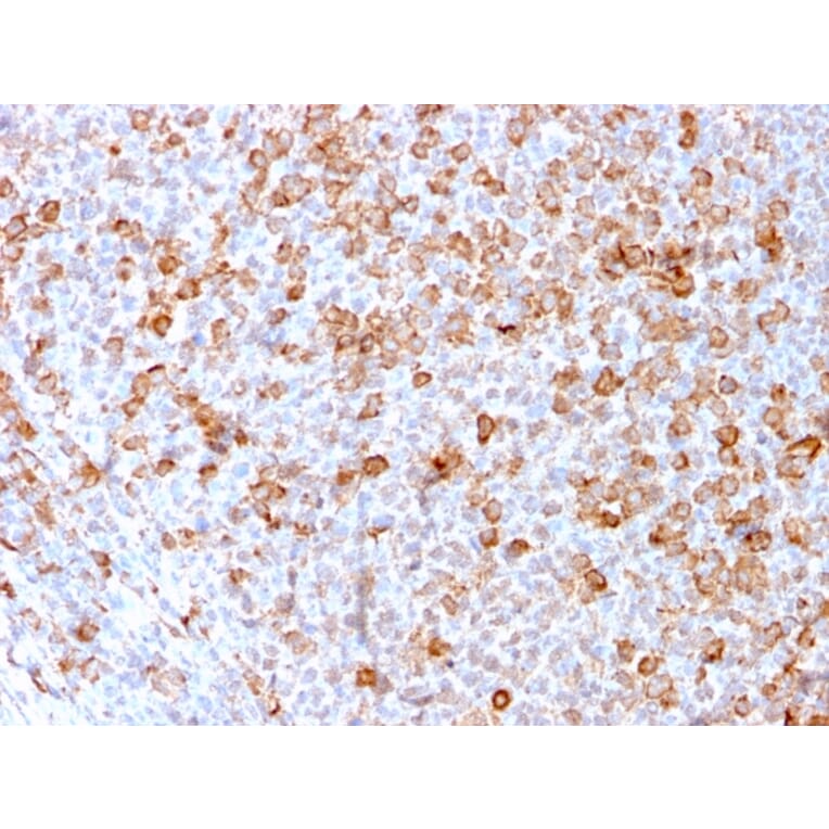 Immunohistochemistry - Anti-CD3 epsilon Antibody [C3e/3171R] (A250507) - Antibodies.com