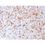 Immunohistochemistry - Anti-CD3 epsilon Antibody [C3e/3171R] (A250507) - Antibodies.com