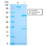 SDS-PAGE - Anti-CD3 epsilon Antibody [C3e/3171R] (A250508) - Antibodies.com