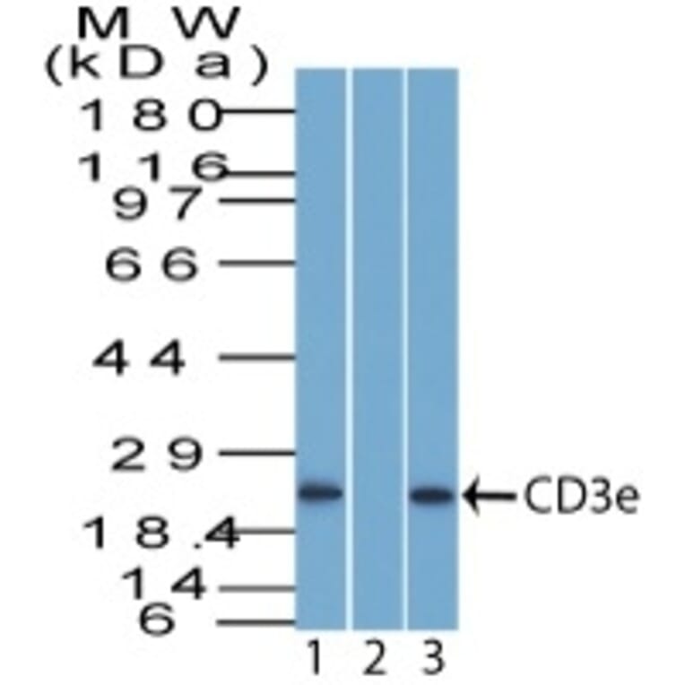 Western Blot - Anti-CD3 epsilon Antibody (A250509) - Antibodies.com