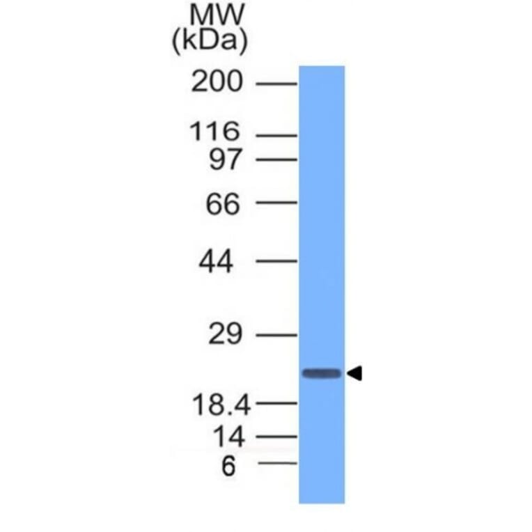Western Blot - Anti-CD3 epsilon Antibody (A250509) - Antibodies.com
