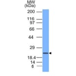 Western Blot - Anti-CD3 epsilon Antibody (A250509) - Antibodies.com