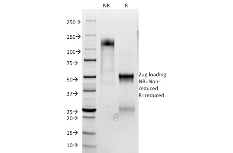 SDS-PAGE - Anti-CD3 epsilon Antibody (A250508) - Antibodies.com