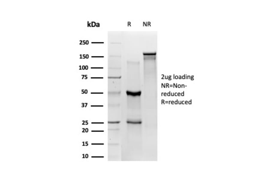 SDS-PAGE - Anti-ZBED1 Antibody [PCRP-ZBED1-1E1] (A250510) - Antibodies.com