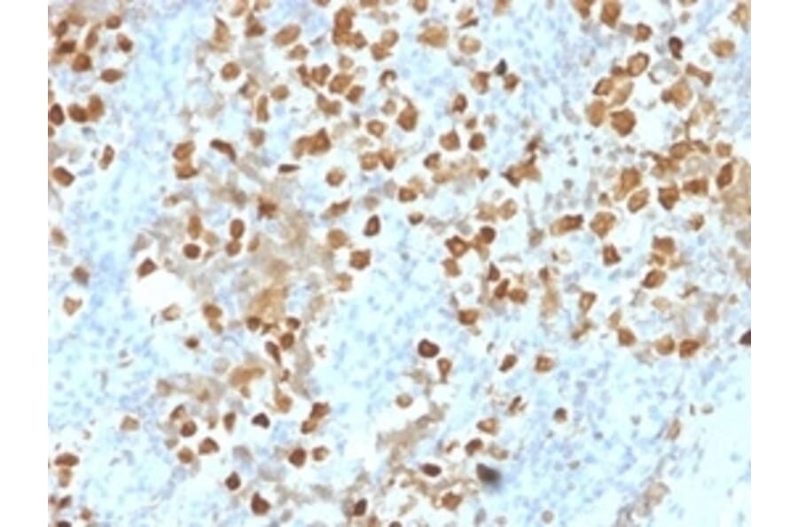 Immunohistochemistry - Anti-ZMYM3 Antibody [PCRP-ZMYM3-2F10] (A250511) - Antibodies.com