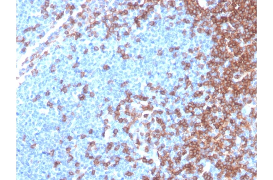 Immunohistochemistry - Anti-CD4 Antibody [rCD4/3930] (A250512) - Antibodies.com