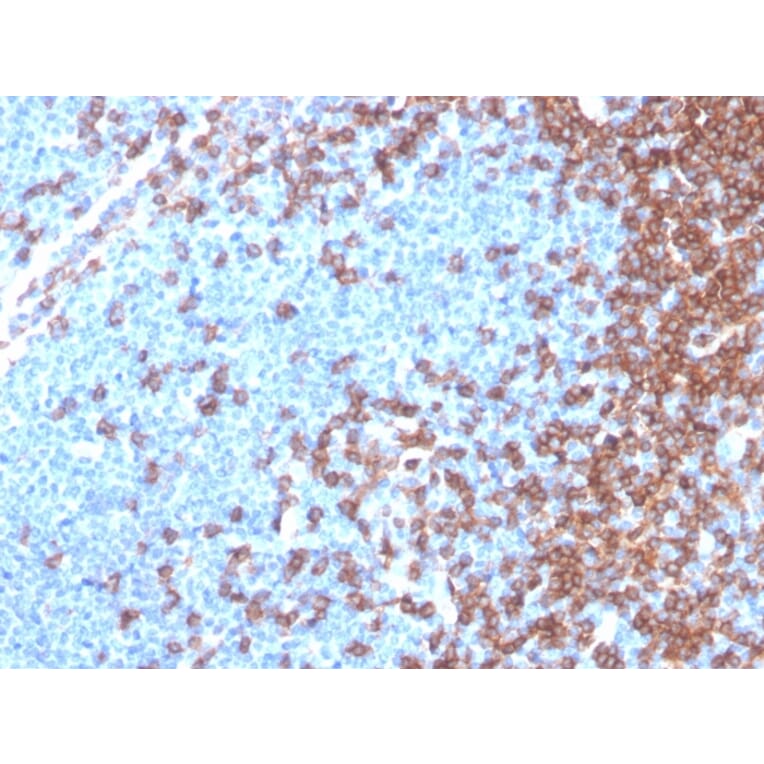 Immunohistochemistry - Anti-CD4 Antibody [rCD4/3930] (A250512) - Antibodies.com