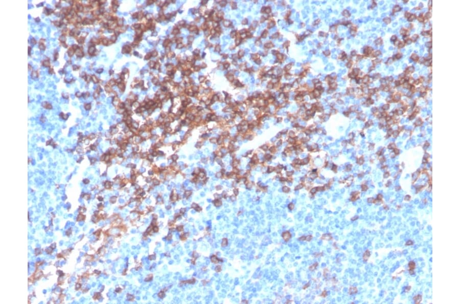 Immunohistochemistry - Anti-CD4 Antibody [rCD4/3930] (A250511) - Antibodies.com