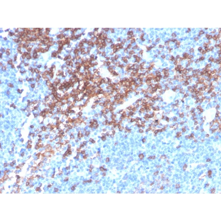 Immunohistochemistry - Anti-CD4 Antibody [rCD4/3930] (A250511) - Antibodies.com