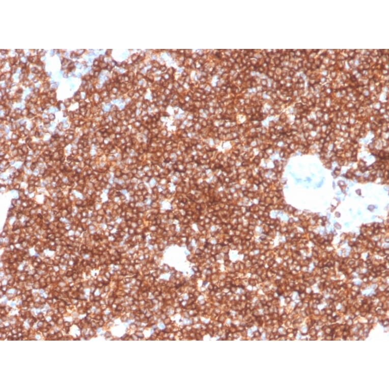 Immunohistochemistry - Anti-CD4 Antibody [rCD4/3930] (A250512) - Antibodies.com