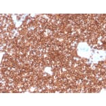 Immunohistochemistry - Anti-CD4 Antibody [rCD4/3930] (A250512) - Antibodies.com