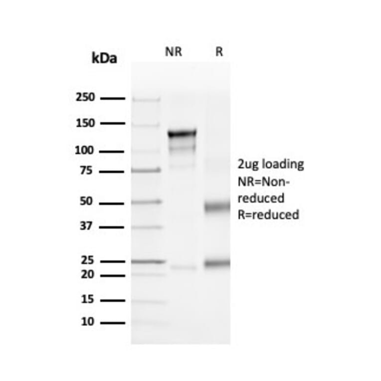 SDS-PAGE - Anti-CD4 Antibody [rCD4/3930] (A250512) - Antibodies.com