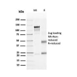 SDS-PAGE - Anti-CD4 Antibody [rCD4/3930] (A250512) - Antibodies.com