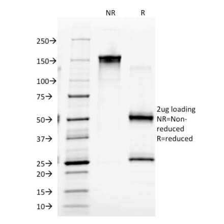 SDS-PAGE - Anti-CD4 Antibody [EDU-2] (A250513) - Antibodies.com