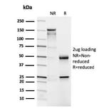 SDS-PAGE - Anti-CD4 Antibody [CD4/3026] (A250517) - Antibodies.com